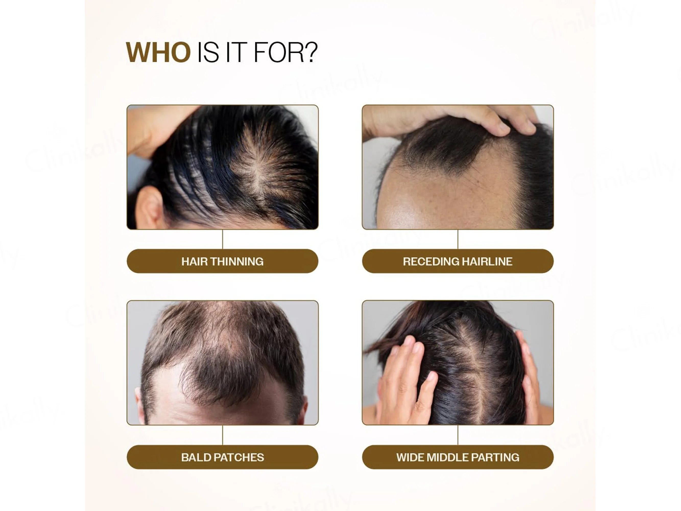 Bare Anatomy Advanced Hair Growth Serum Roll-On - Image 3