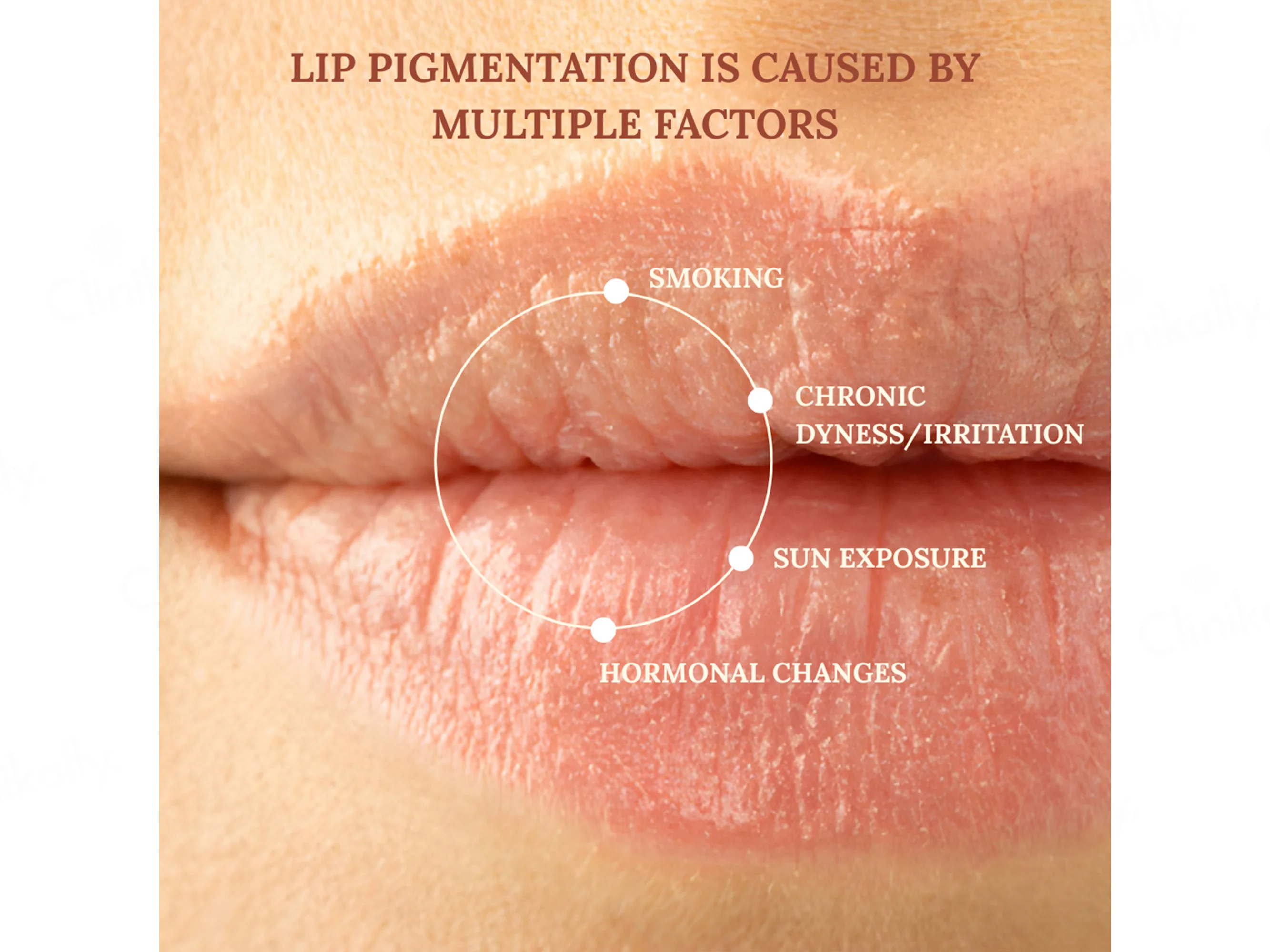 DERMAIN Lip Lightening Balm SPF 30 - Image 3