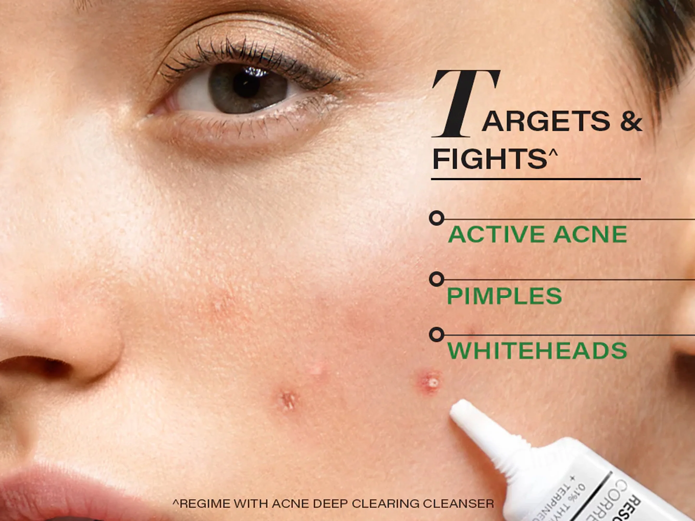 Novology Acne Rescue Spot Corrector Gel - Image 5