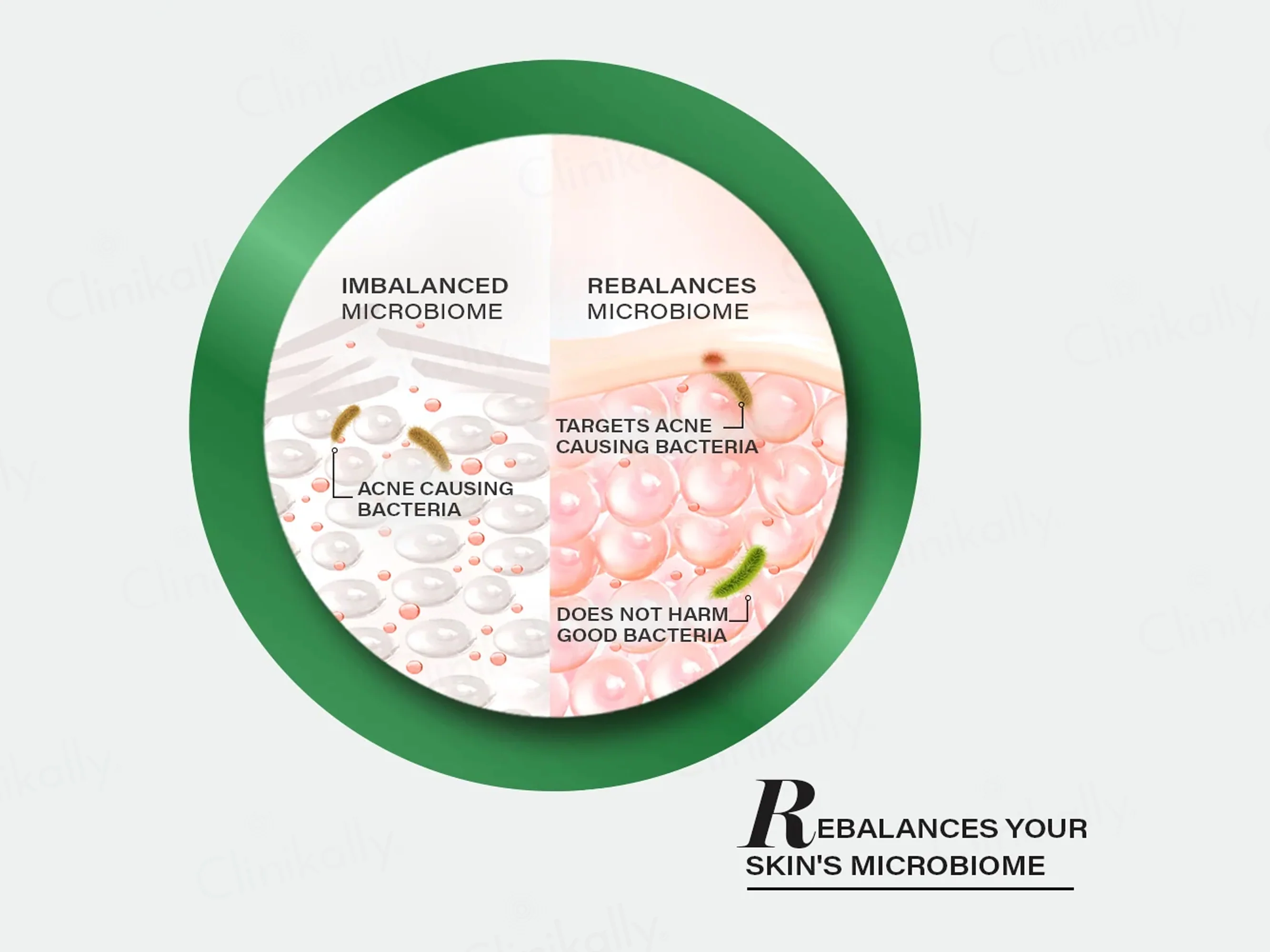 Novology Acne Rescue Spot Corrector Gel - Image 7
