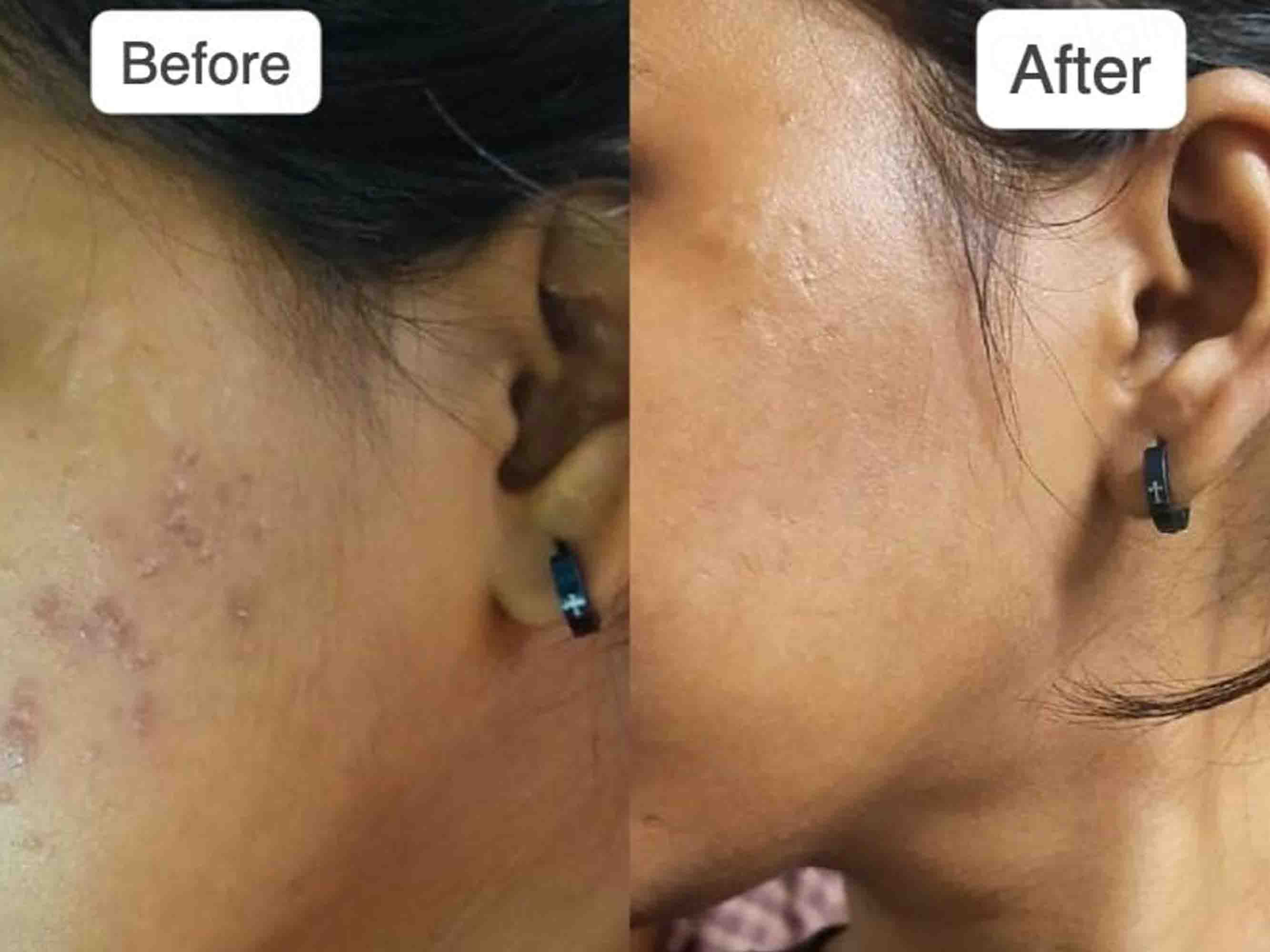 Vilvah Store Milk Drop Brightening Serum - Image 4